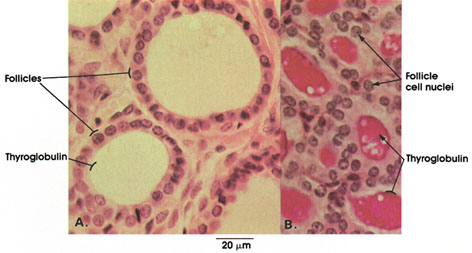 Plate 15.286 Thyroid Gland