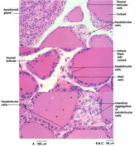 Plate 15.287 Parafollicular Cells
