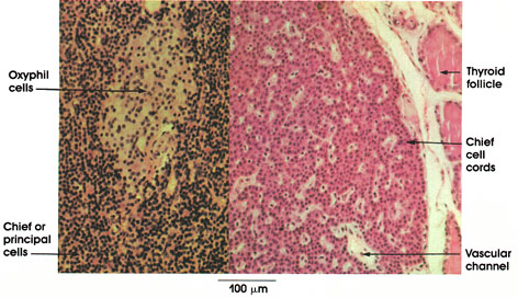 Plate 15.289 Parathyroid Gland