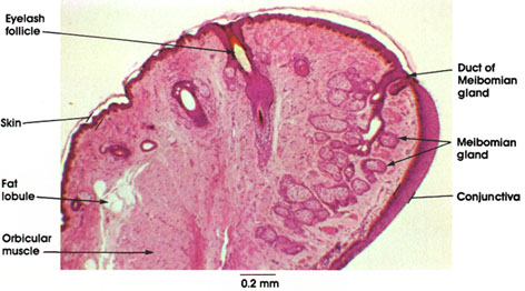 Plate 16.309 Eyelid