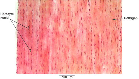 Plate 3.32: Collagenous Connective Tissue