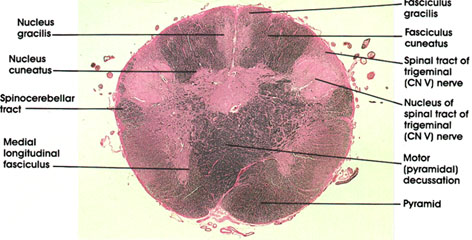 Plate 17.326 Medula Oblongata