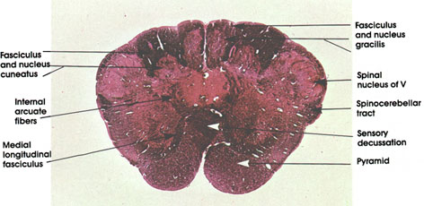 Plate 17.328 Medulla Oblongata