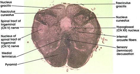 Plate 17.329 Medulla Oblongata