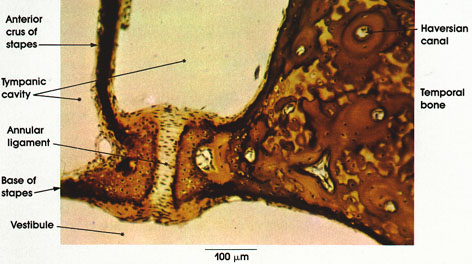 Plate 3.33: Ligament