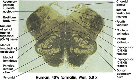 Plate 17.331 Medulla Oblongata