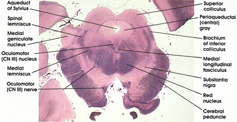 Plate 17.340 Mesencephalon