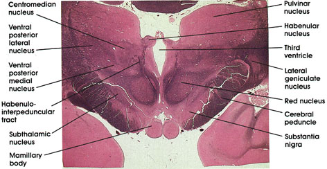 Plate 17.342 Diencephalon