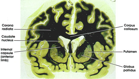 Plate 17.346 Basal Ganglia