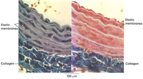 Plate 3.35: Elastic Membranes; Collagenous Fibers