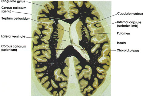 Plate 17.352 Basal Ganglia