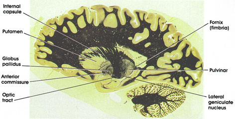 Plate 17.360 Section through Lenticular Nucleus and Lateral Geniculate Nucleus