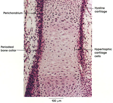 Plate 3.43: Endochondral Ossification