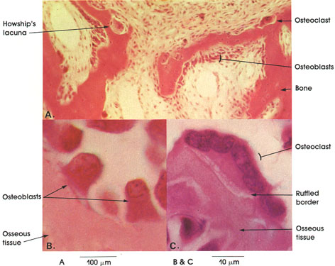 Plate 3.46: Membrane Bone