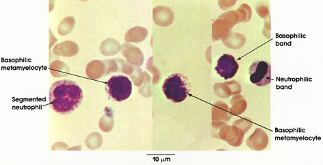 Plate 4.60: Bone Marrow