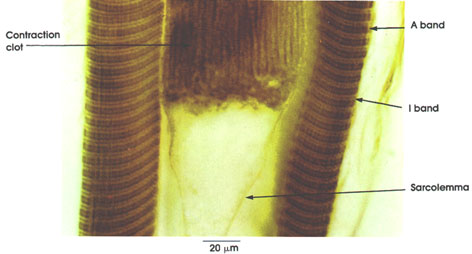 Plate 5.64: Striated Muscle