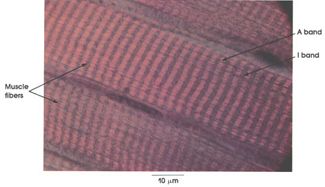 Plate 5.65: Striated Muscle