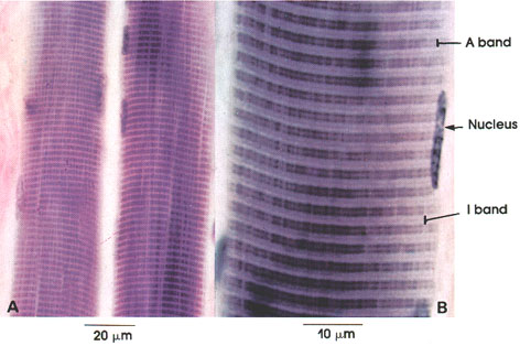 Plate 5.66: Striated Muscle