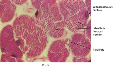 Plate 5.71: Striated Muscle