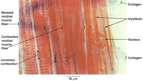 Plate 5.77: Cardiac Muscle