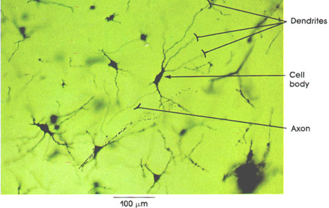 Plate 6.87 Cerebral Cortex: Pyramidal Cells