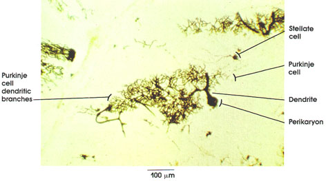 Plate 6.99 Cerebellum: Purkinje cell