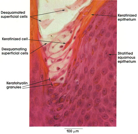 Plate 7.136 Keratinization