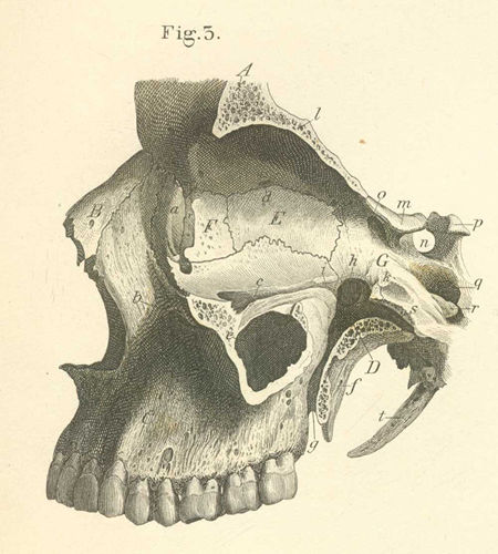 The inner wall of the bones of the orbit