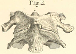 The bones of the trunk with the left scapula, seen from the front.