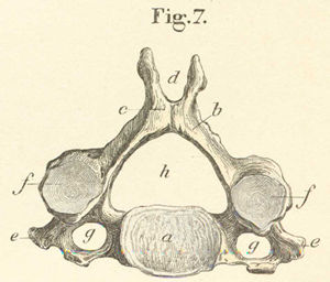 This figure is of a cervical vertebra seen from the front.
