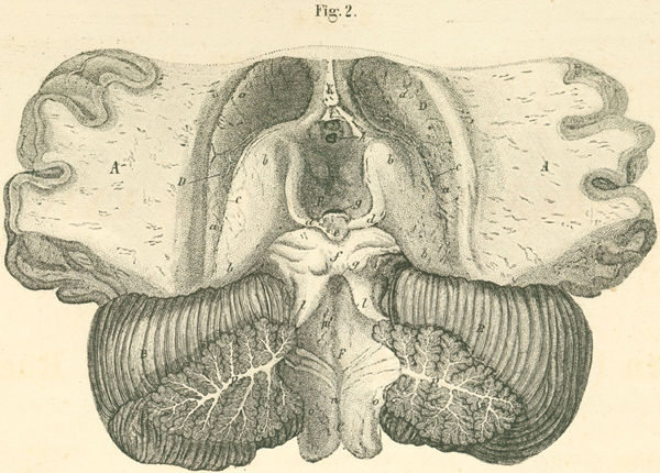 The opened ventricle of the brain, seen from abov