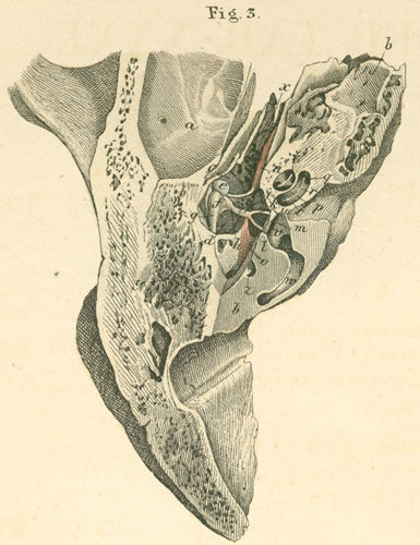 The interior (tympanic cavity, cochlea, vestibule) of the left ear