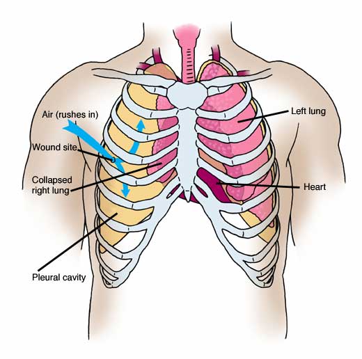 Chest anatomy