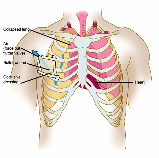 Chest anatomy