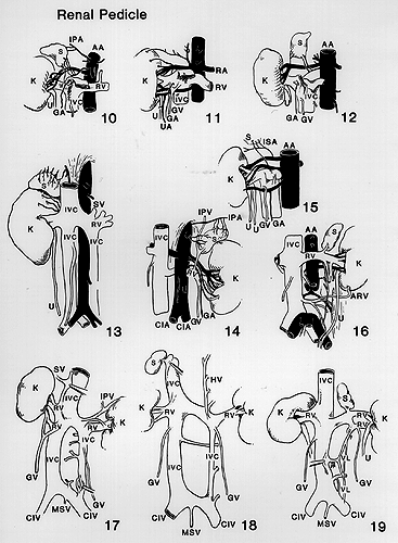 image of renal vascular pedicle