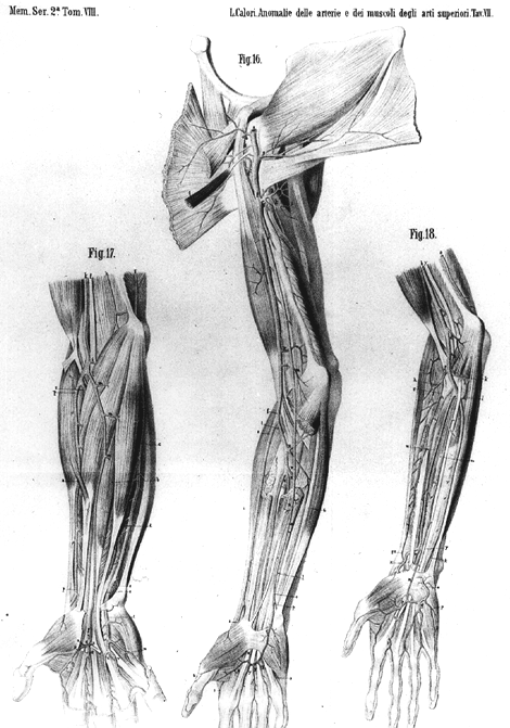 Image of varieties of arteries of the arm