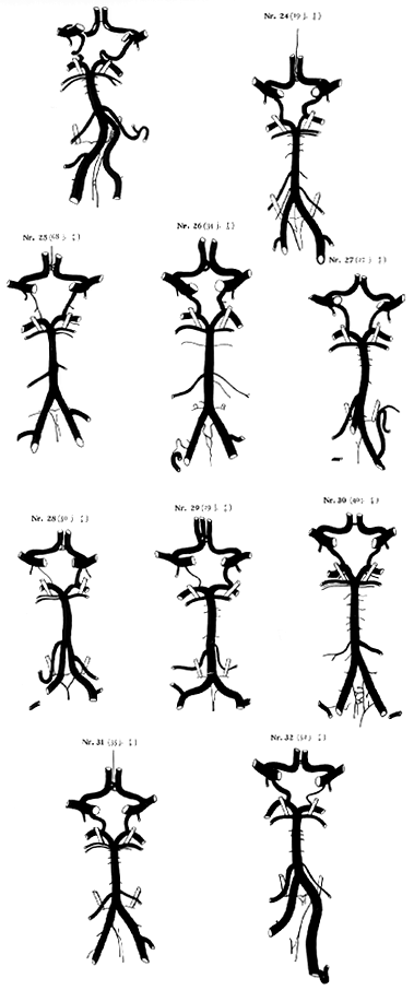 Image of variatiosn in circle of Wilis