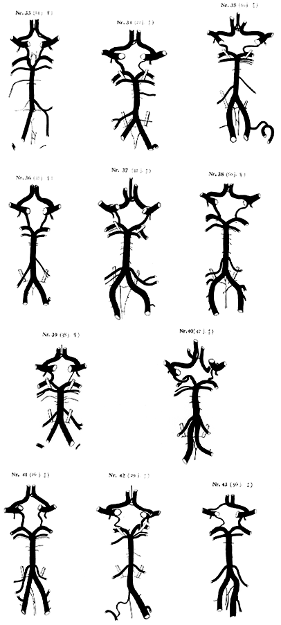 Image of variations in circle of Willis