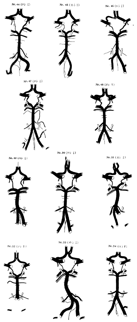 Image of variations in circle of Willis