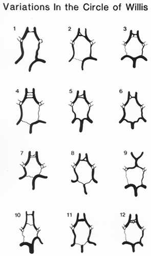 Image Of Variations In Circle Of Willis Image Of Variations In Circle Of Willis