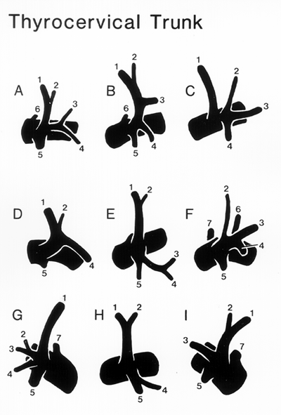 Image of differnet forms of thyrocervical trunk