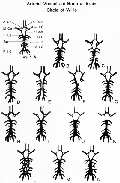 Image of arterial vessels at base of brain