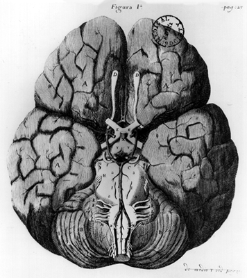 Image of circle of Willis