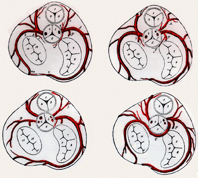 Image of ostia of coronary arteries