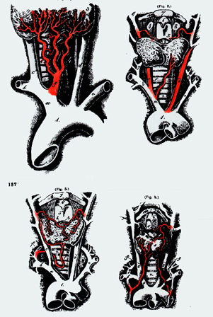 Image of thyroidea ima from brachiocephalic trunk, thyrocervical trunk, and internal thoracic arteries