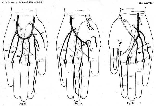 Image of some variations in deep palmar arch