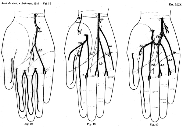 Image of some variations in deep palmar arch