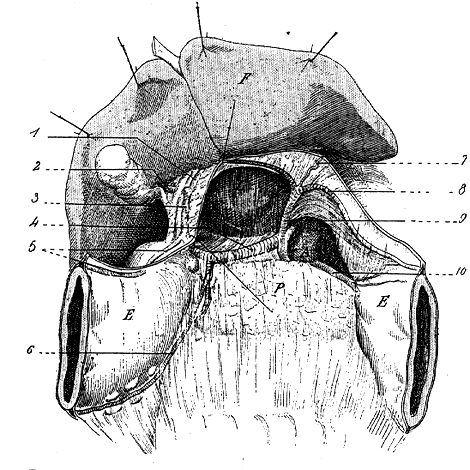 Image of doubled hepatic artery