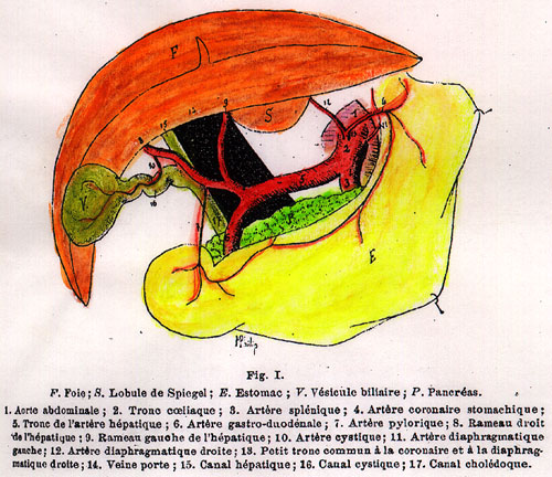 Image of coeliac trunk, some variations of branches