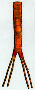Image of common iliac arteries